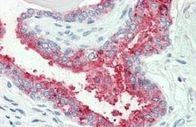 Immunohistochemistry-Paraffin: NKCC1/SLC12A2 Antibody [NBP3-14422] - NKCC1/SLC12A2 antibody IHC of human prostate. Immunohistochemistry of formalin-fixed, paraffin-embedded tissue after heat-induced antigen retrieval.